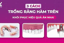 Nhai Đồ Ăn Hàm Kêu